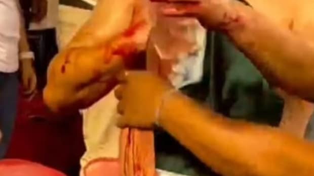 A Mexico fan pictured holding his jersey over a stab wound after being attacked during a game in Santa Clara during the 2023 CONCACAF Gold Cup